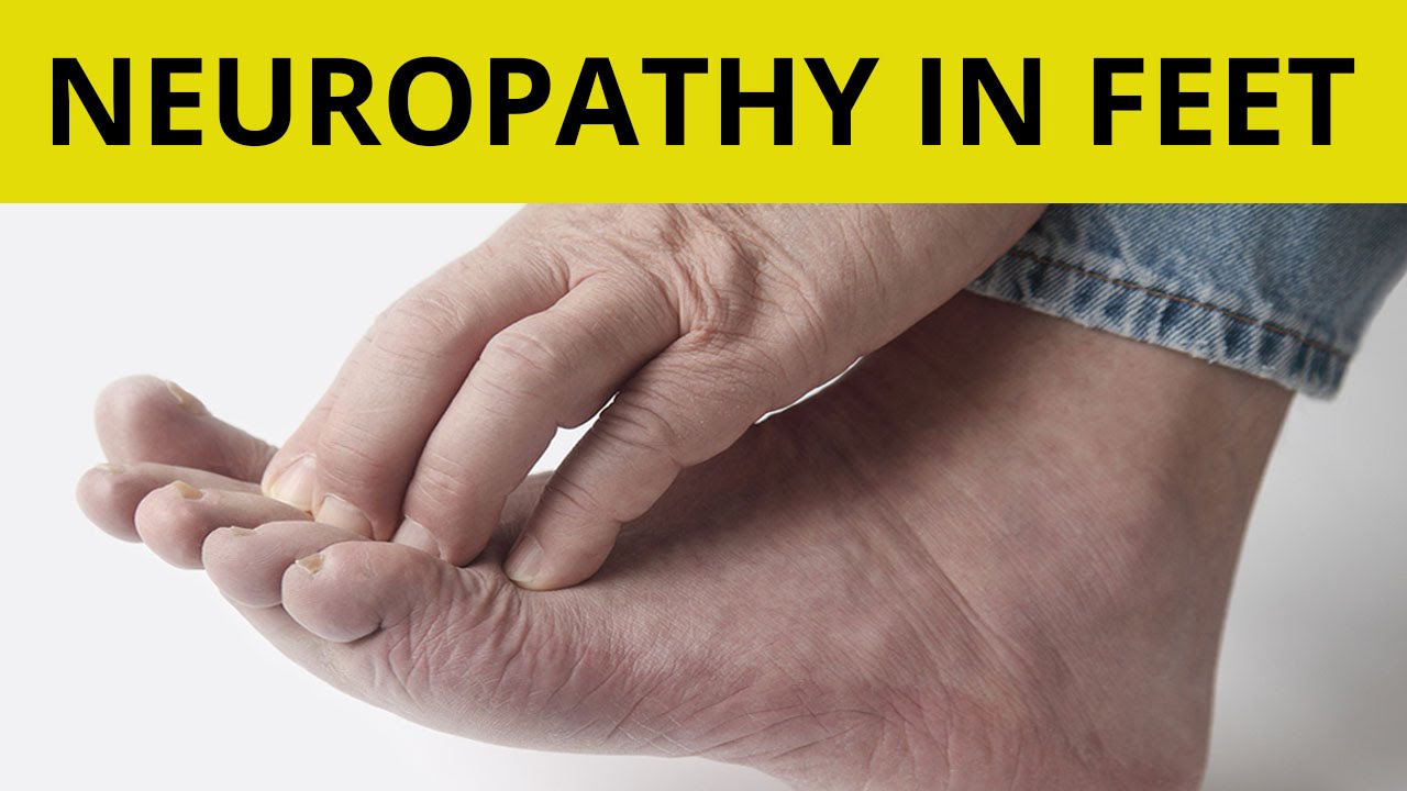 How to Know if You Have Neuropathy in Your Feet