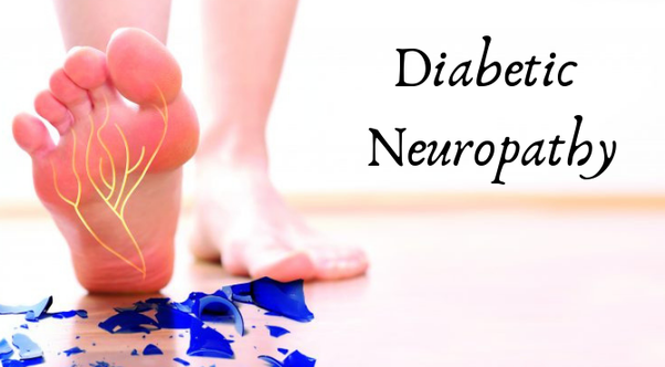 Diabetic Neuropathy: Treatment, Symptoms, Causes